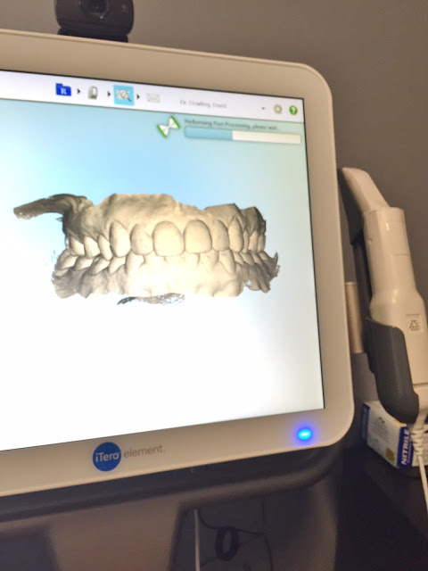 Smile Direct Club review featured by top US life and style blog, Hello! Happiness