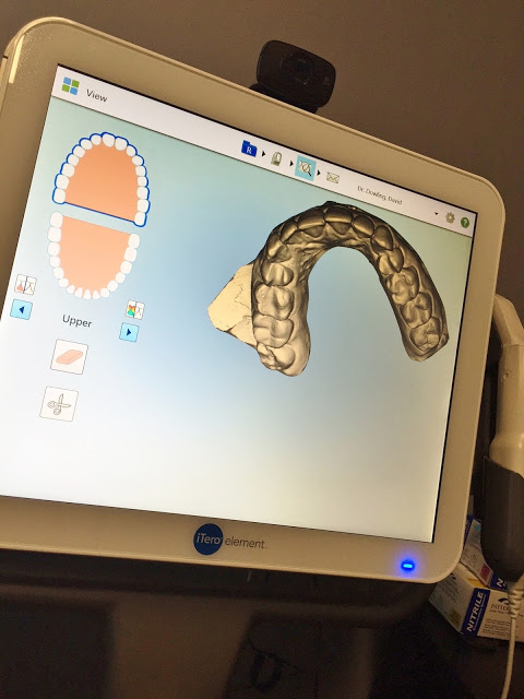 Smile Direct Club review featured by top US life and style blog, Hello! Happiness