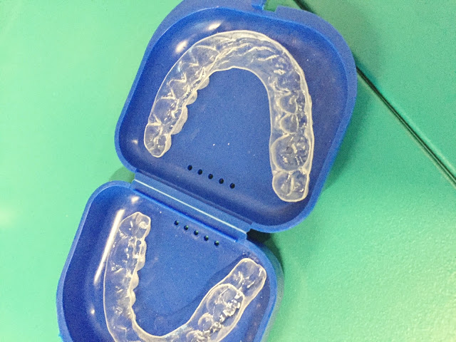 Smile Direct Club review featured by top US life and style blog, Hello! Happiness